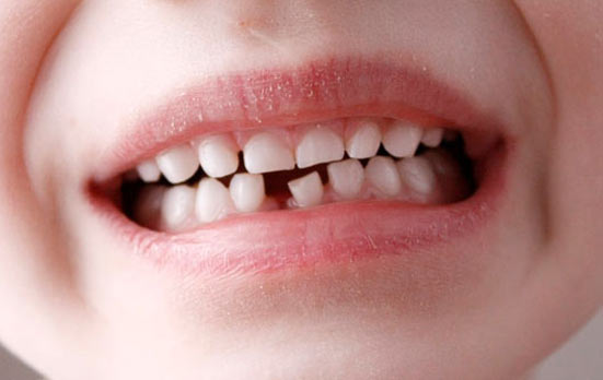 ankara diş hekimi guniz dental dis kliniği